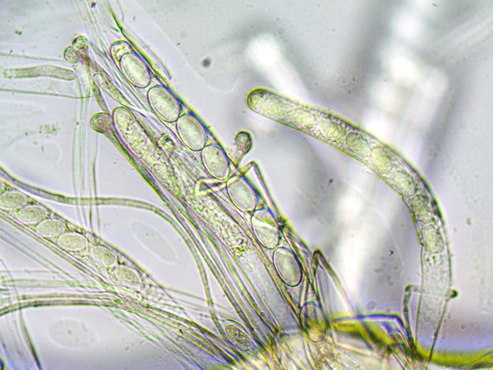 Pseudaleuria fibrillosaSpores01