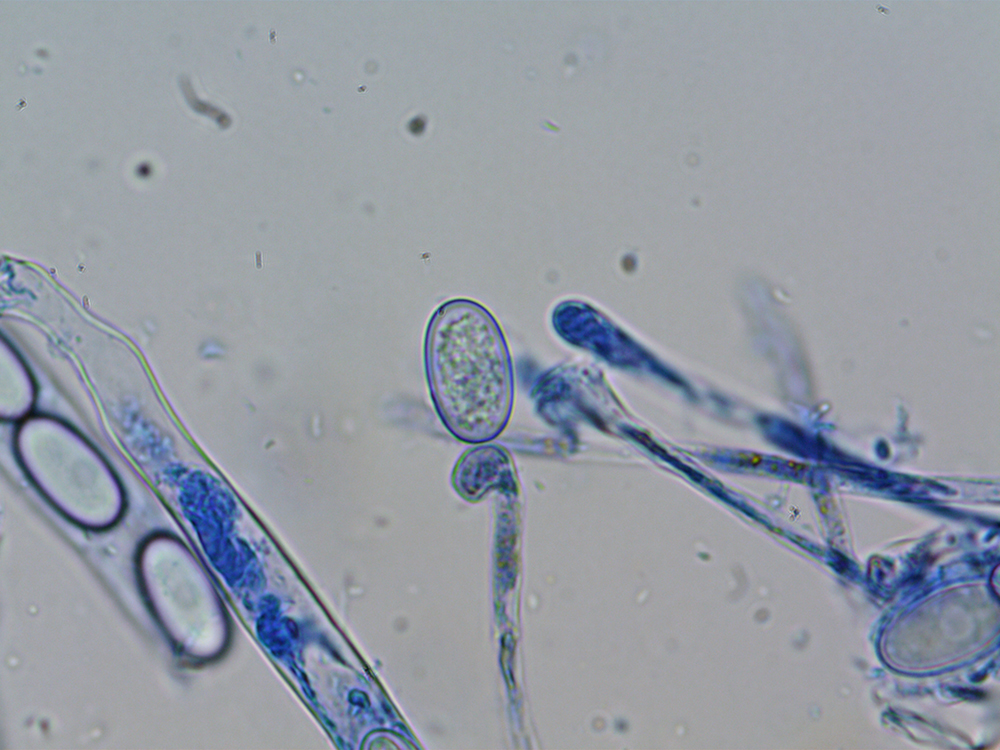 Pseudaleuria fibrillosaSpores02