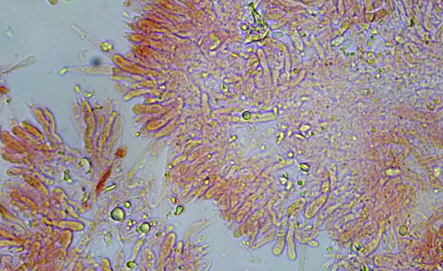 Artomyces basidia x 60 (1)