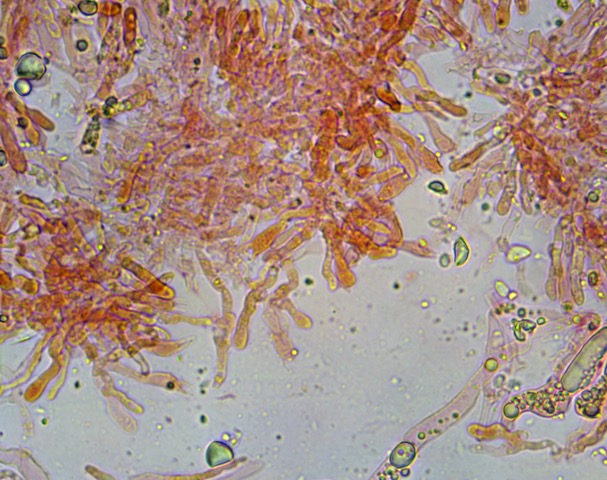 Artomyces basidia, gleocystidia x 60
