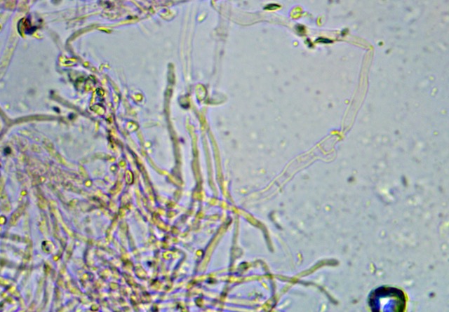 Artomyces clamp x 60