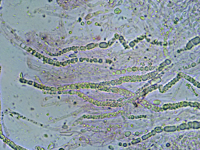 Artomyces gleocystidia x 60 (1)