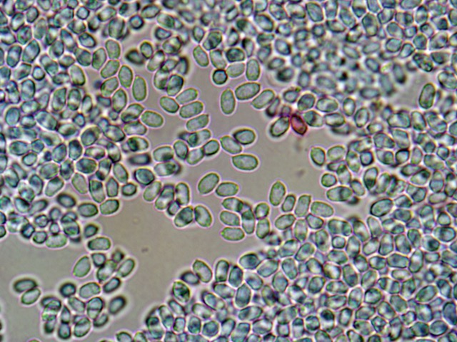 Artomyces spores x 100 2